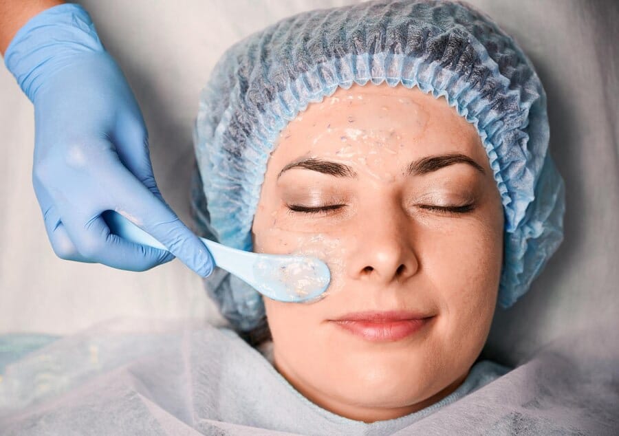 Chemical Peels Chemical Peels