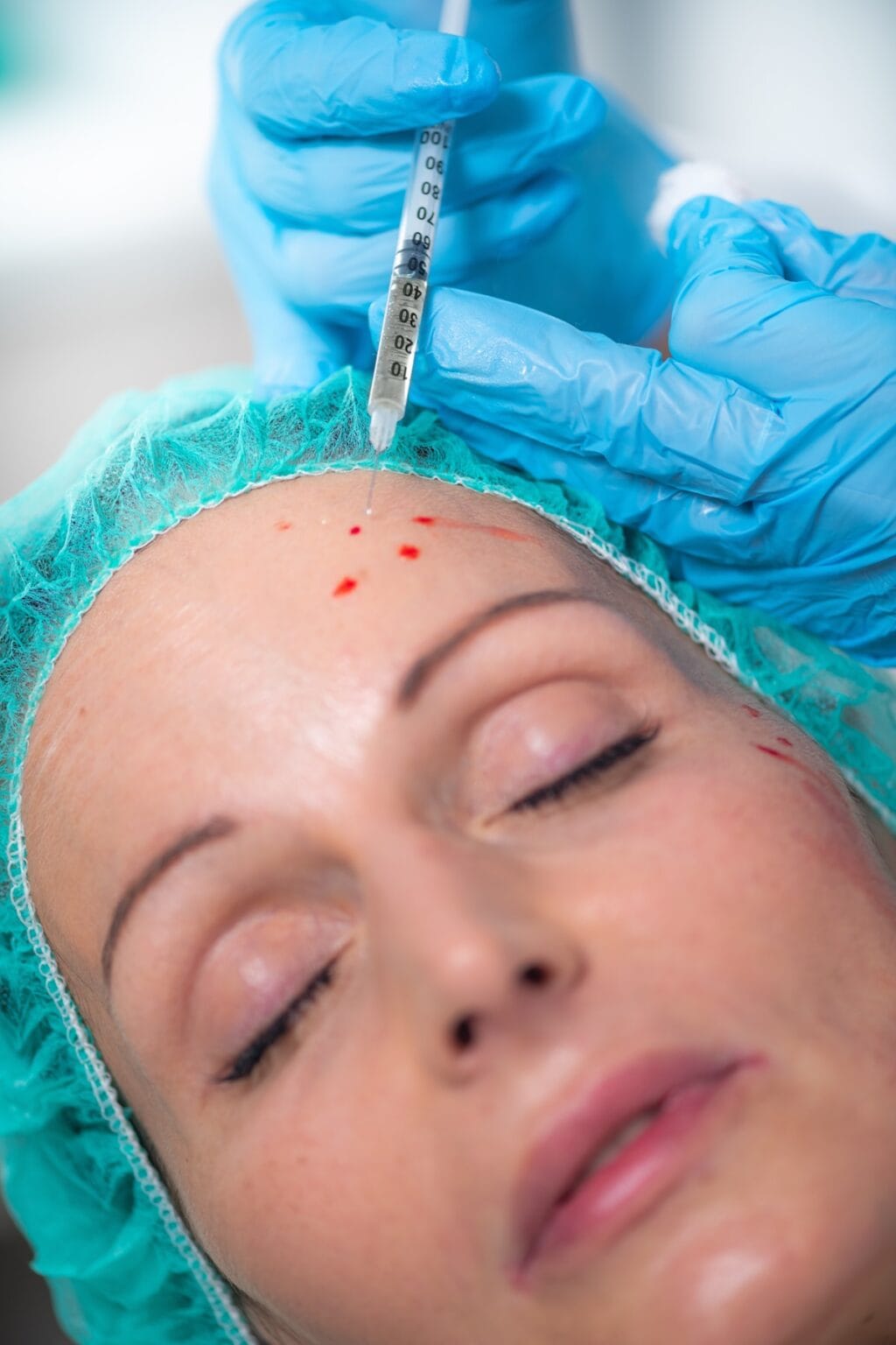 PRP Therapy PRP Therapy