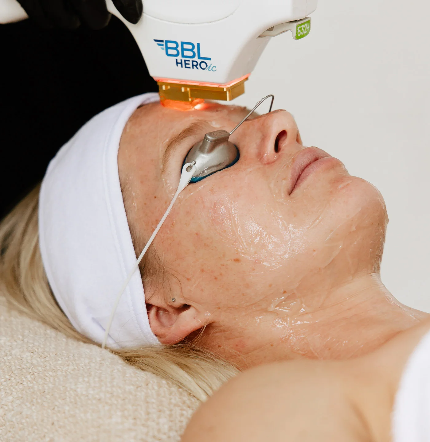 bbl skin revujenation bbl skin revujenation