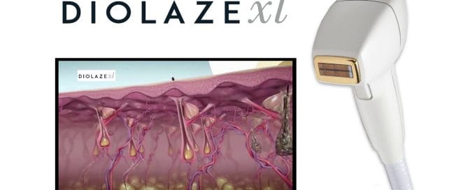 A Berwyn Patient Had Laser Hair Removal at Another Clinic and It Didn't Work. Here's What We Found.