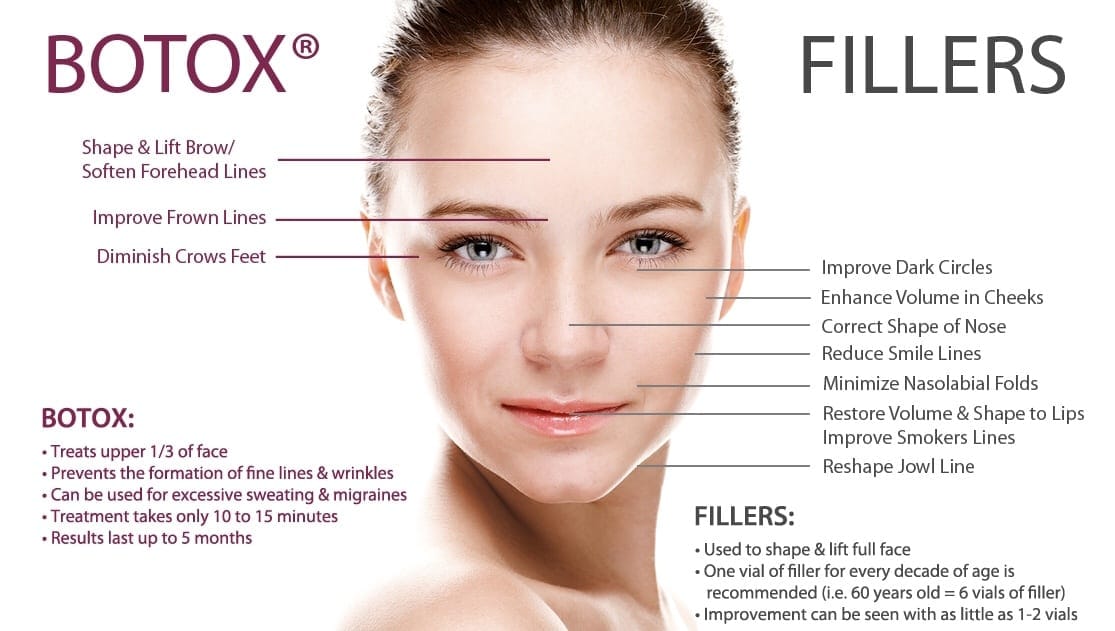Botox and fillers at Elite Med Spa in Berwyn