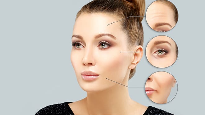 Common Botox treatment areas on the face