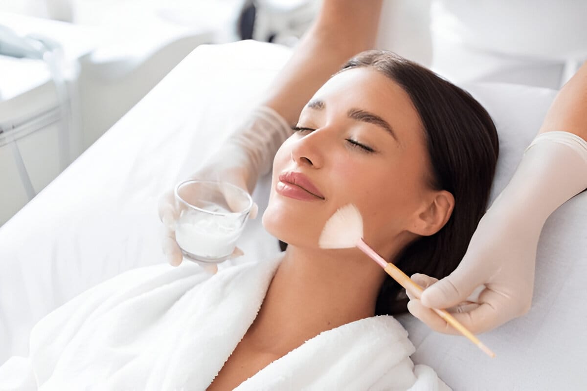 Chemical peels in Berwyn