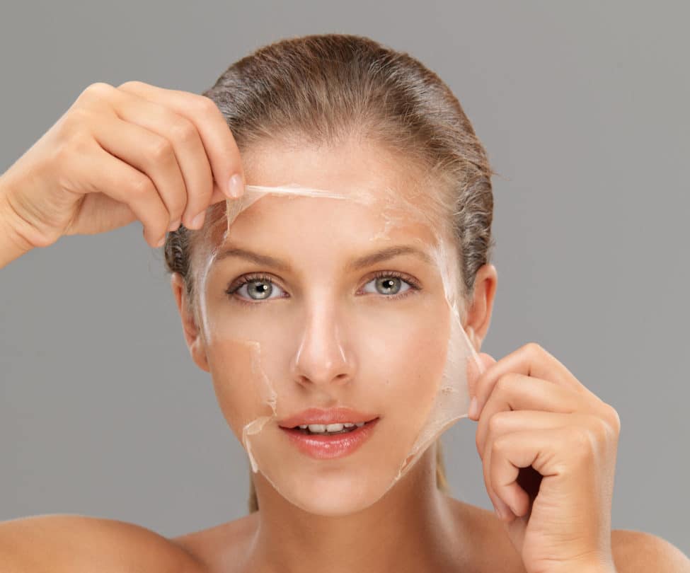 Skin concerns chemical peels can improve in Berwyn
