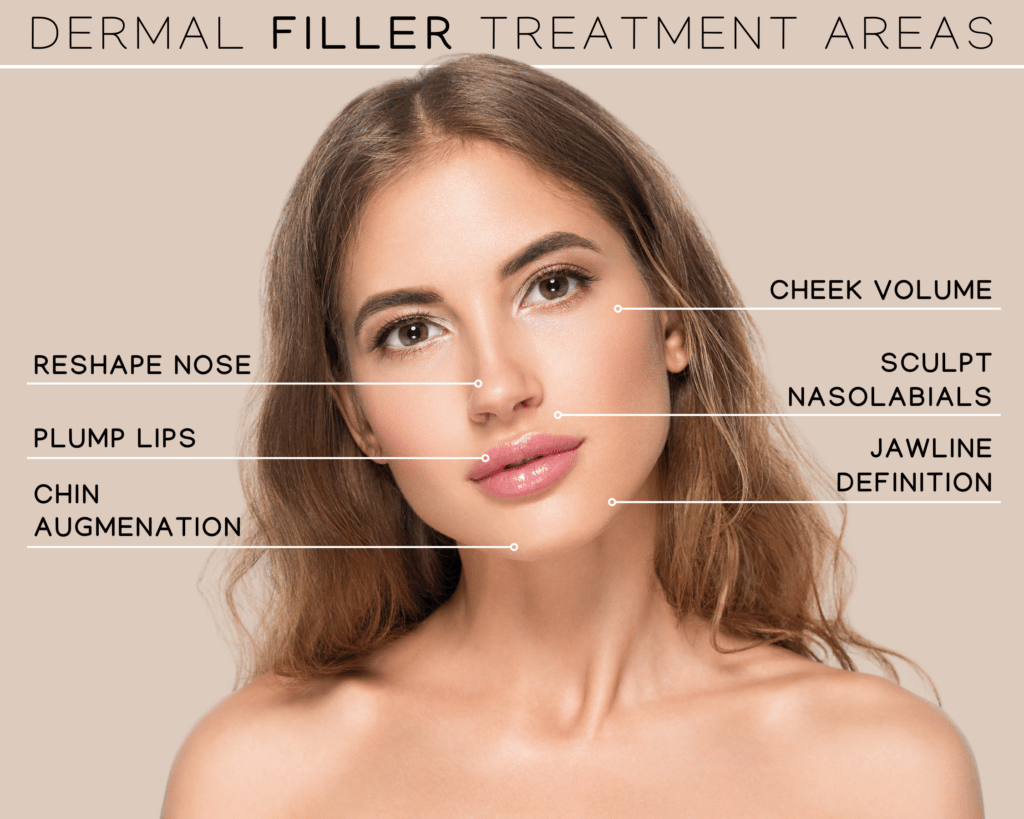 Dermal filler treatment and aftercare in Berwyn