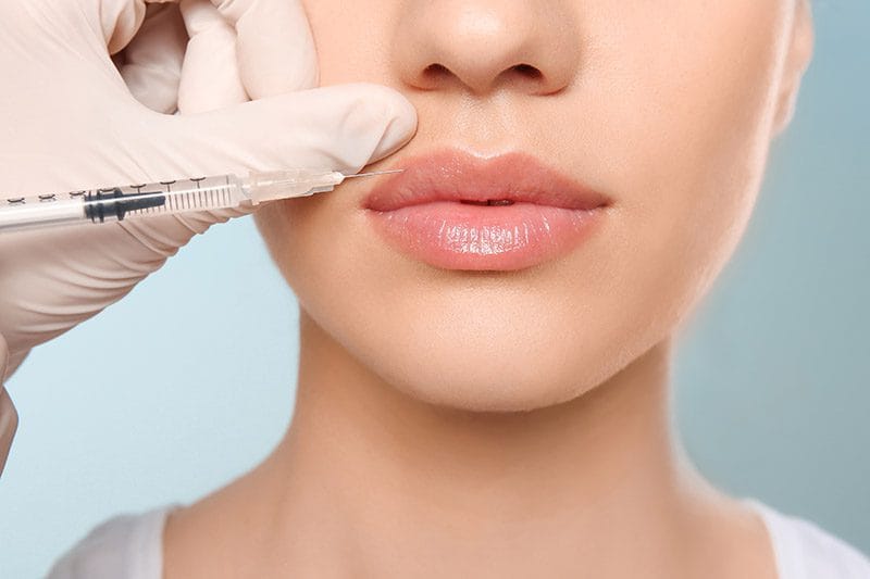 Dermal fillers near Oak Lawn IL