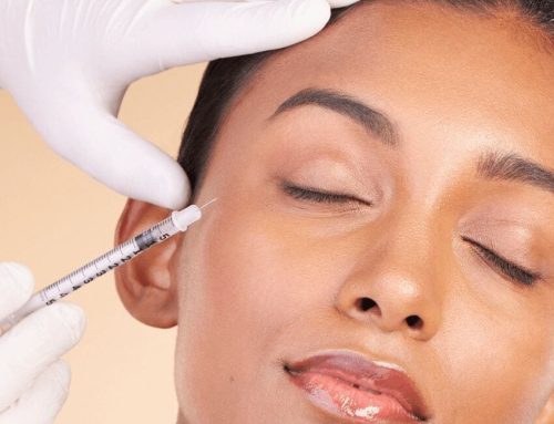 Botox in Chicago: 2026 Prices, Units, Results and Trends