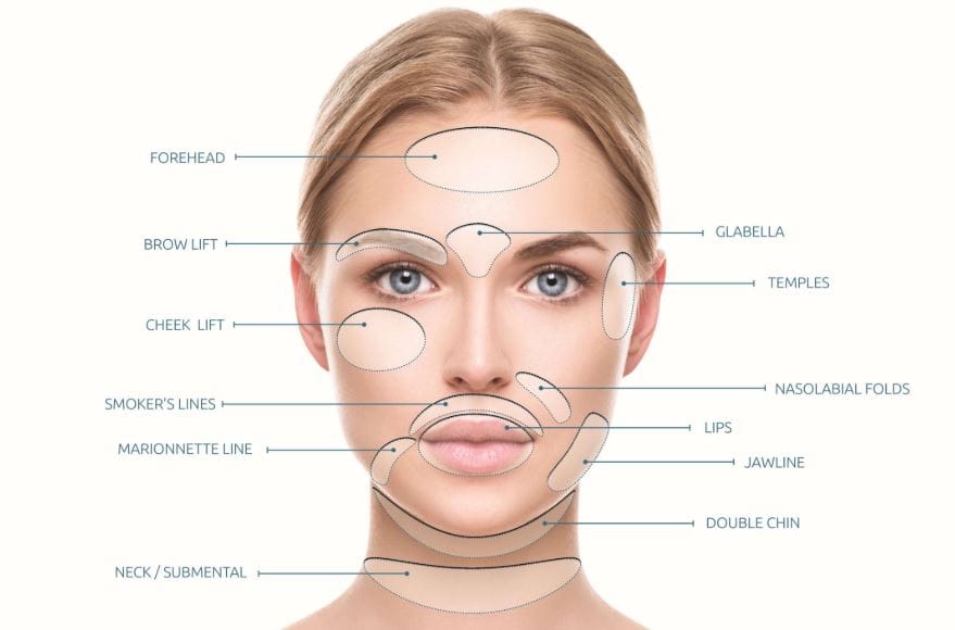Areas a PDO thread lift can treat