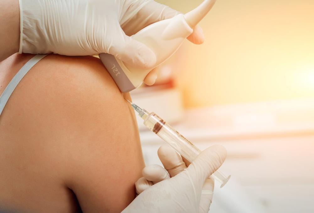PRP therapy appointment in Berwyn