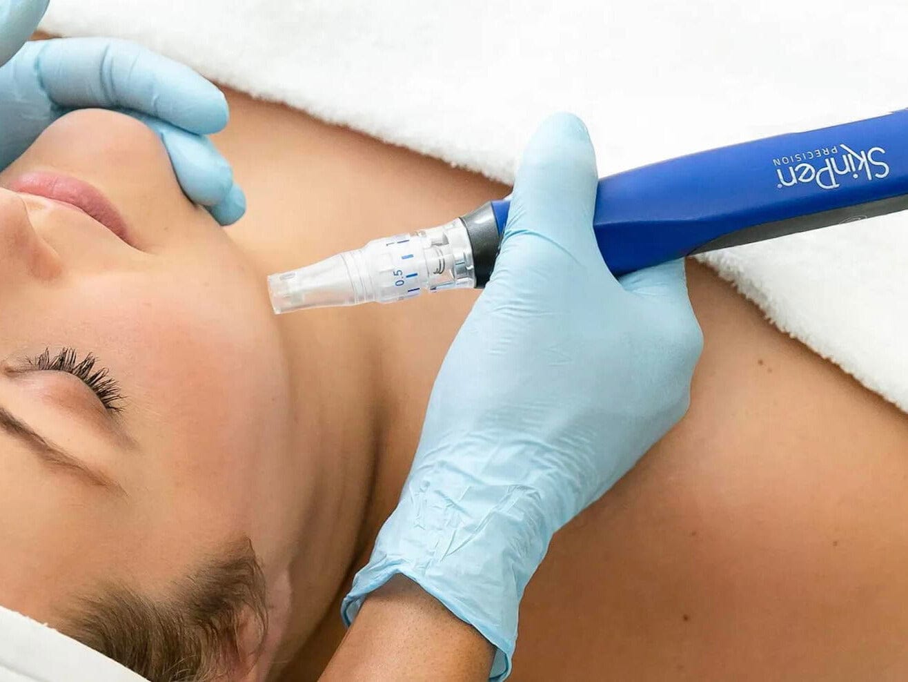 SkinPen microneedling treatment at Elite Med Spa Berwyn