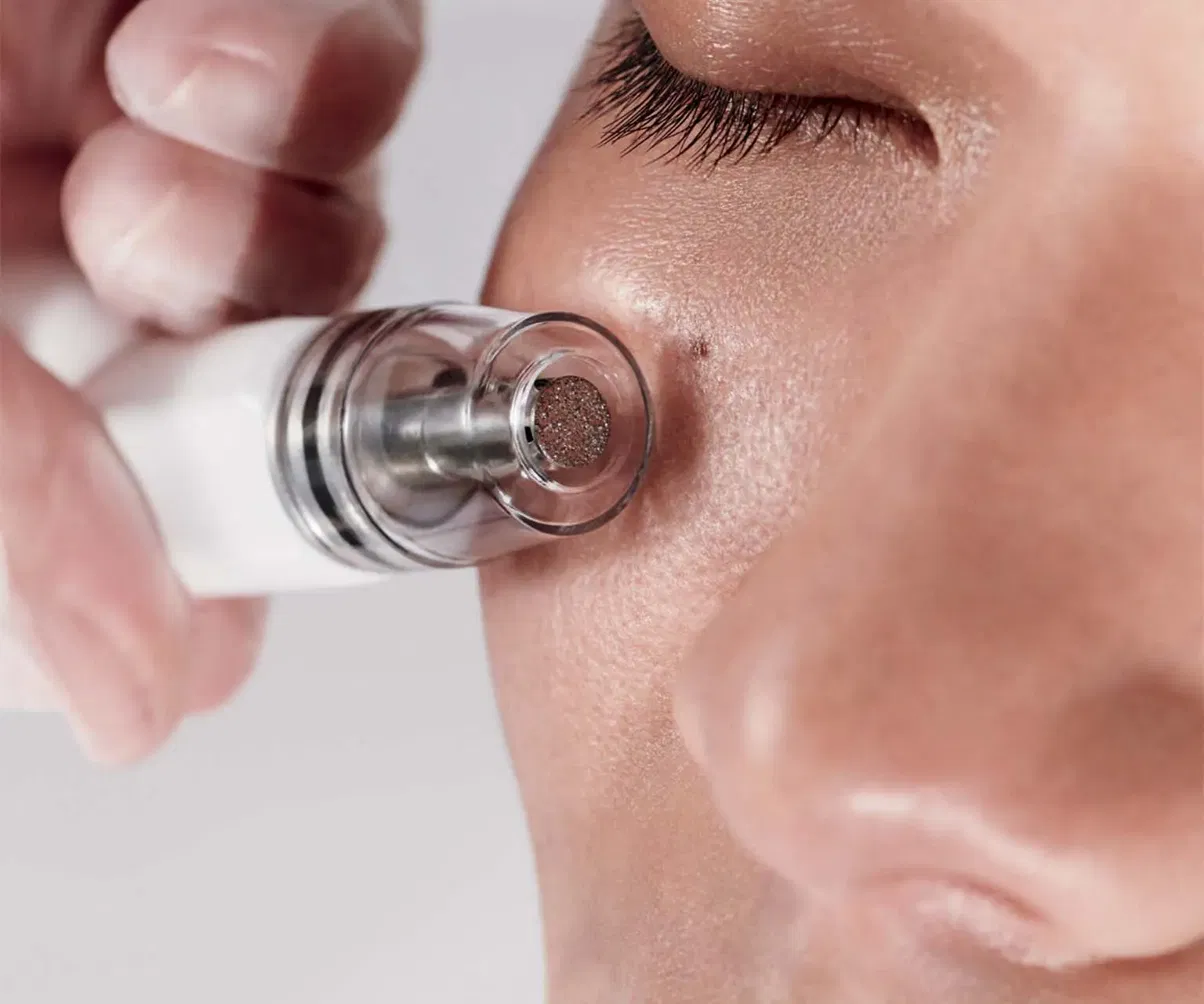 Close-up of the DiamondGlow diamond-tip wand resurfacing the skin